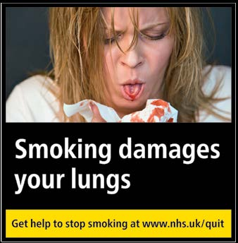 Smoking damages your lungs