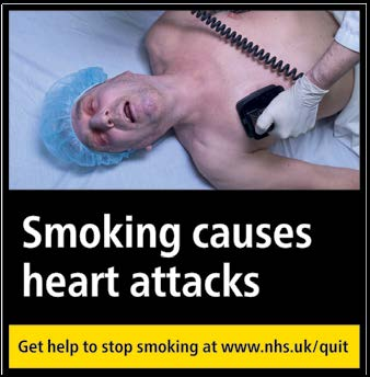 Smoking causes heart attacks