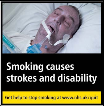 Smoking causes strokes and disability