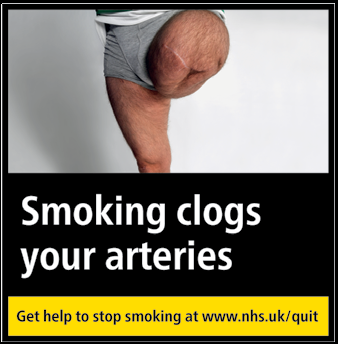Smoking clogs your arteries