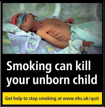 Smoking can kill your unborn child